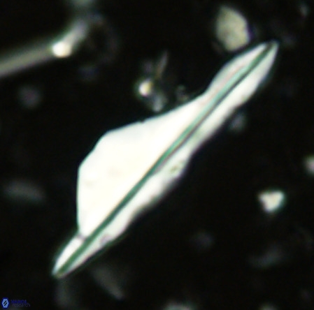 Pseudotriquetrorhabdulus inversus VR 02660