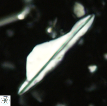 Pseudotriquetrorhabdulus inversus VR 02660