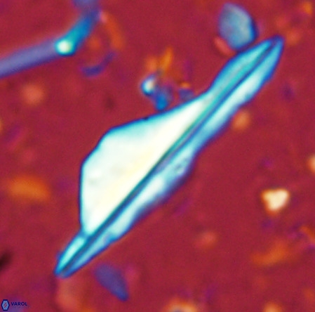 Pseudotriquetrorhabdulus inversus VR 02661