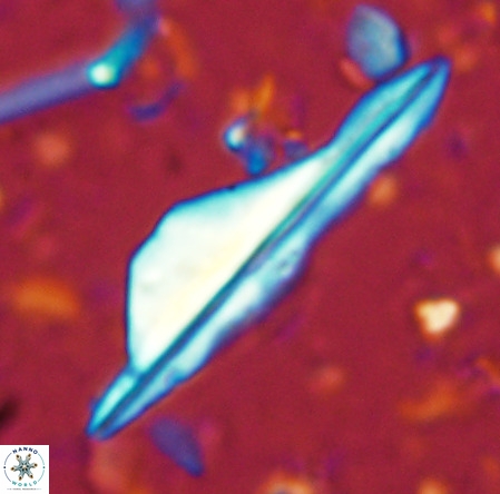 Pseudotriquetrorhabdulus inversus VR 02661