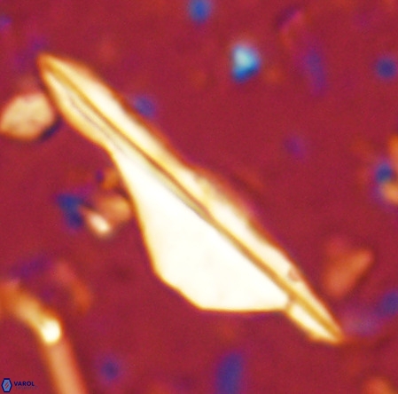 Pseudotriquetrorhabdulus inversus VR 02662