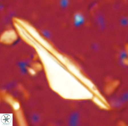 Pseudotriquetrorhabdulus inversus VR 02662