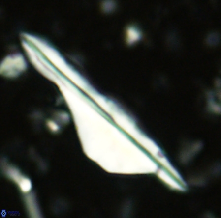 Pseudotriquetrorhabdulus inversus VR 02663