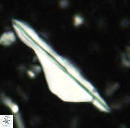 Pseudotriquetrorhabdulus inversus VR 02663