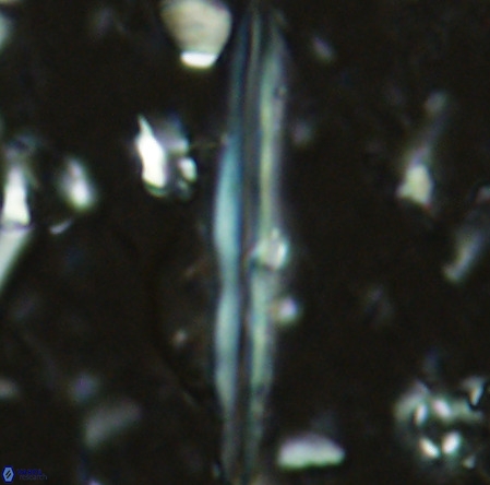 Pseudotriquetrorhabdulus inversus VR 02666