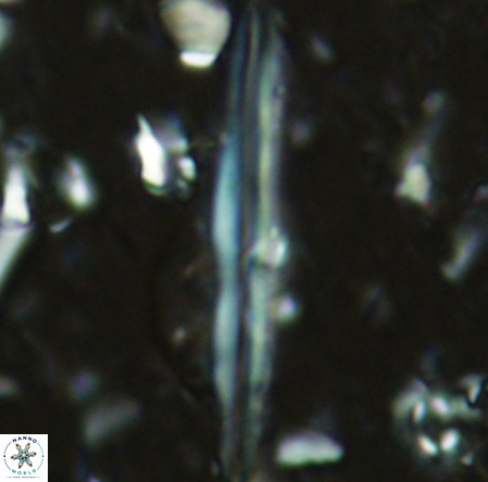 Pseudotriquetrorhabdulus inversus VR 02666