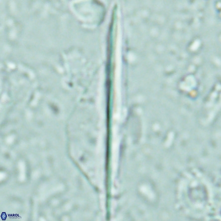 Pseudotriquetrorhabdulus inversus VR 02667