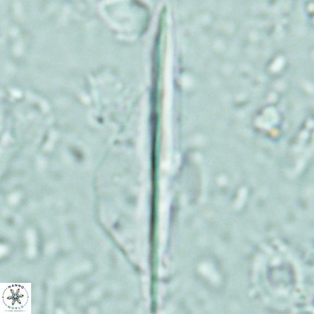 Pseudotriquetrorhabdulus inversus VR 02667