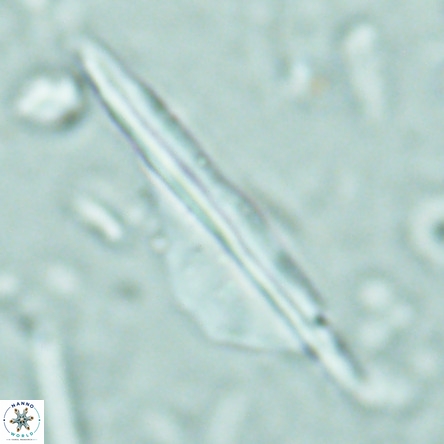 Pseudotriquetrorhabdulus inversus VR 02668