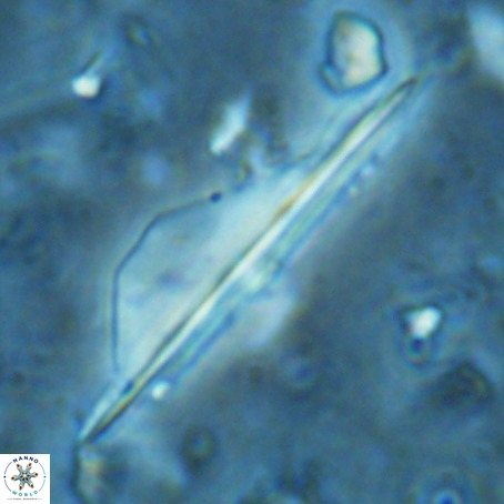 Pseudotriquetrorhabdulus inversus VR 02670