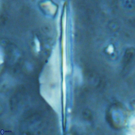Pseudotriquetrorhabdulus inversus VR 02671