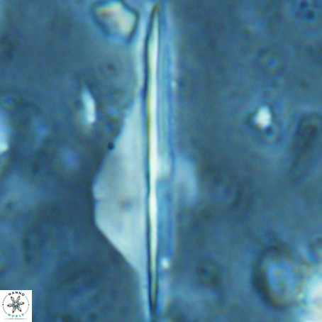 Pseudotriquetrorhabdulus inversus VR 02671