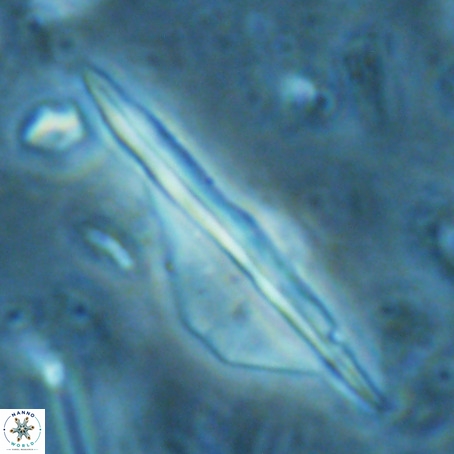 Pseudotriquetrorhabdulus inversus VR 02672