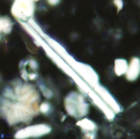 Pseudotriquetrorhabdulus inversus VR 02929