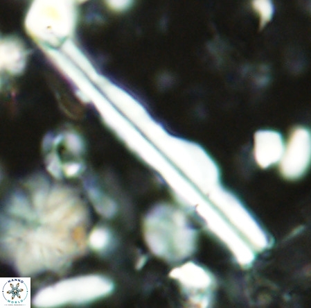 Pseudotriquetrorhabdulus inversus VR 02929