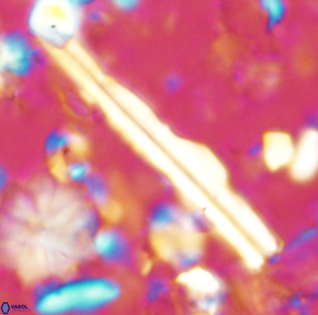 Pseudotriquetrorhabdulus inversus VR 02930