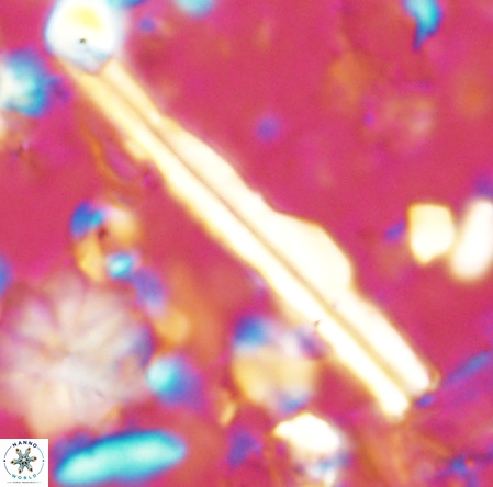 Pseudotriquetrorhabdulus inversus VR 02930