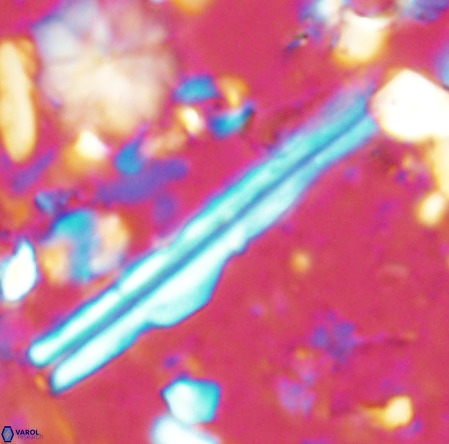 Pseudotriquetrorhabdulus inversus VR 02931