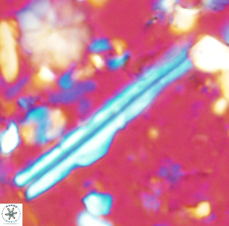 Pseudotriquetrorhabdulus inversus VR 02931