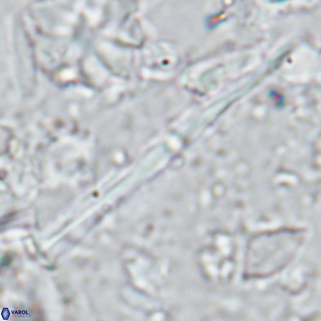 Pseudotriquetrorhabdulus inversus VR 02933