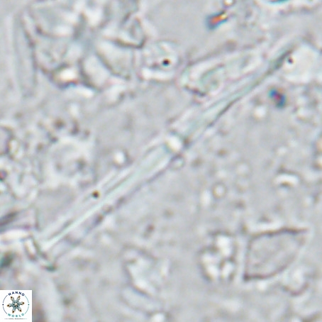 Pseudotriquetrorhabdulus inversus VR 02933