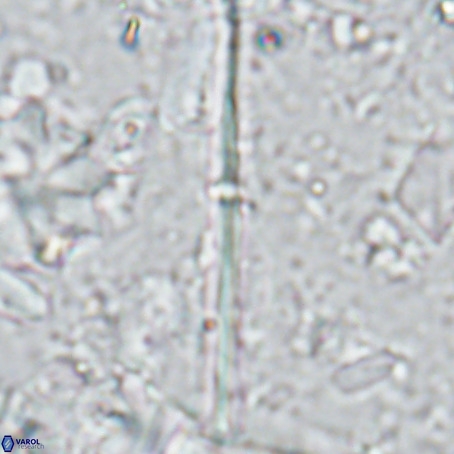Pseudotriquetrorhabdulus inversus VR 02934