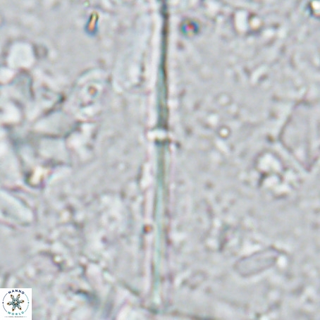 Pseudotriquetrorhabdulus inversus VR 02934