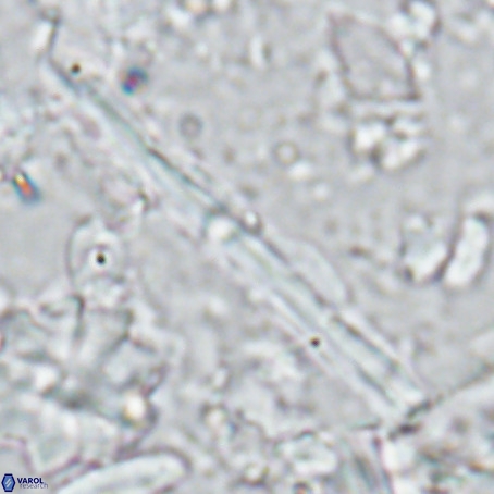 Pseudotriquetrorhabdulus inversus VR 02935