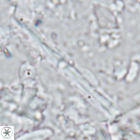 Pseudotriquetrorhabdulus inversus VR 02935