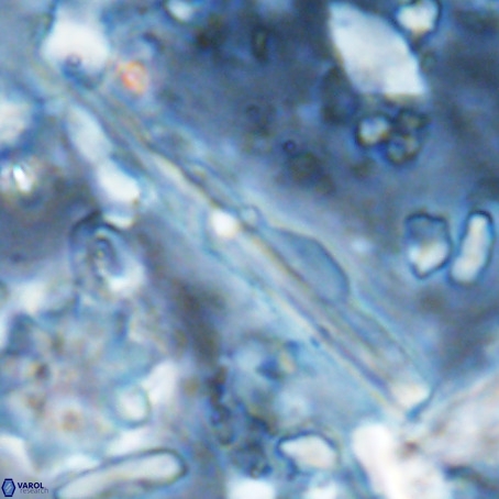 Pseudotriquetrorhabdulus inversus VR 02936