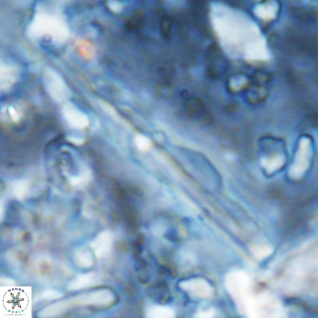 Pseudotriquetrorhabdulus inversus VR 02936