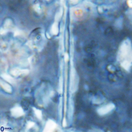 Pseudotriquetrorhabdulus inversus VR 02937