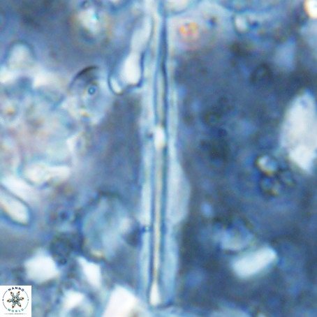 Pseudotriquetrorhabdulus inversus VR 02937