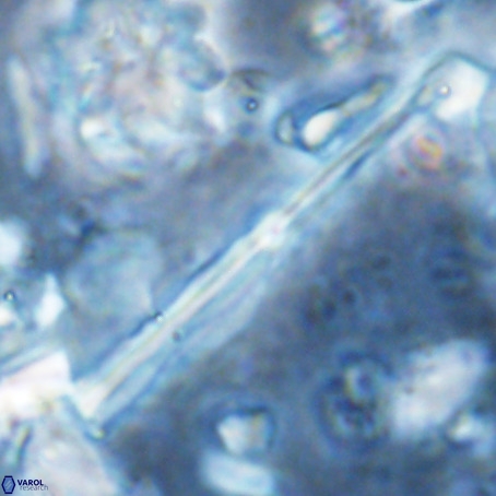 Pseudotriquetrorhabdulus inversus VR 02938