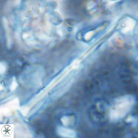 Pseudotriquetrorhabdulus inversus VR 02938