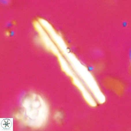 Pseudotriquetrorhabdulus inversus VR 33954