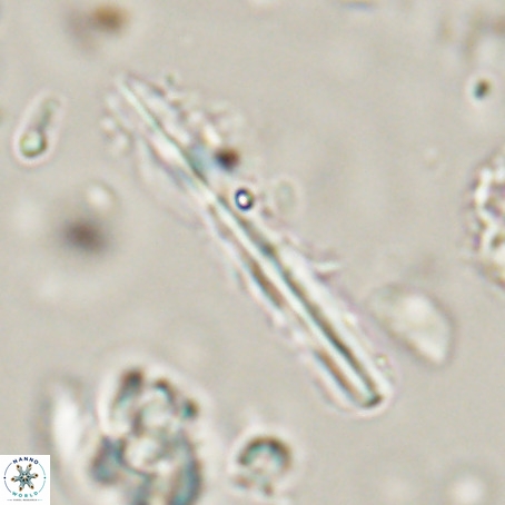 Pseudotriquetrorhabdulus inversus VR 33957