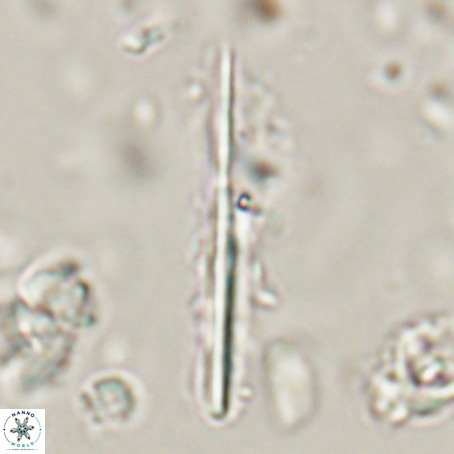Pseudotriquetrorhabdulus inversus VR 33958
