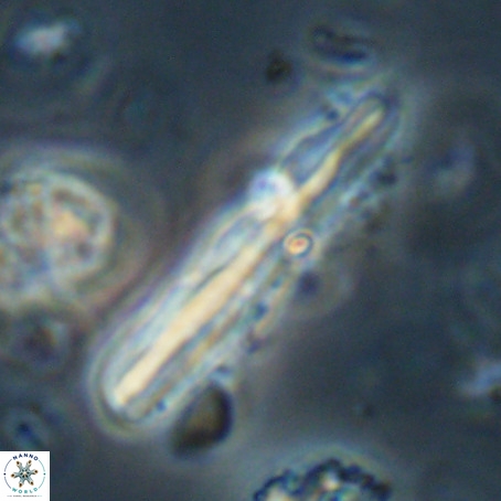 Pseudotriquetrorhabdulus inversus VR 33960