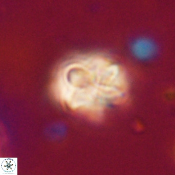 Pseudotriquetrorhabdulus inversus VR 33979