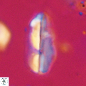 Pseudotriquetrorhabdulus inversus VR 33980