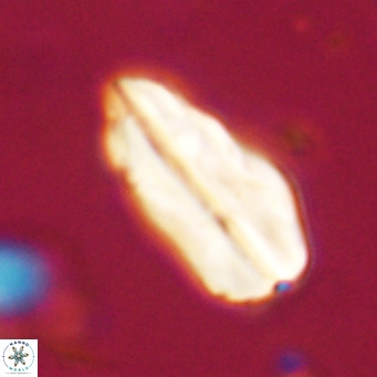 Pseudotriquetrorhabdulus inversus VR 33981