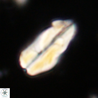 Pseudotriquetrorhabdulus inversus VR 33983