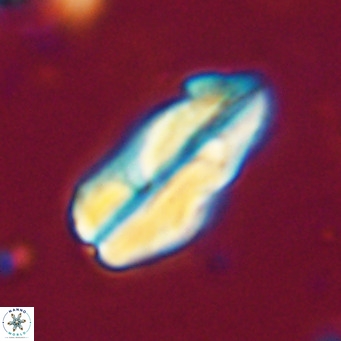 Pseudotriquetrorhabdulus inversus VR 33984