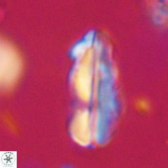 Pseudotriquetrorhabdulus inversus VR 33985