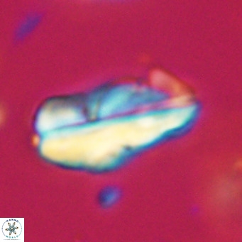 Pseudotriquetrorhabdulus inversus VR 33988