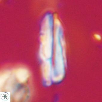 Pseudotriquetrorhabdulus inversus VR 33997