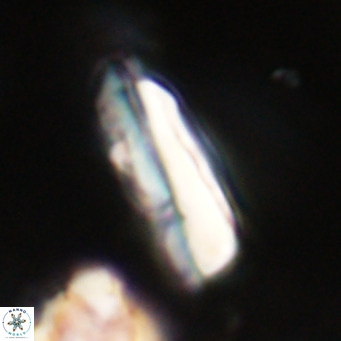 Pseudotriquetrorhabdulus inversus VR 34000
