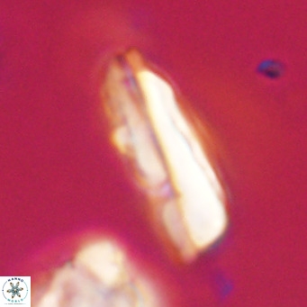 Pseudotriquetrorhabdulus inversus VR 34001