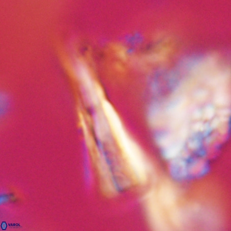 Pseudotriquetrorhabdulus stilus VR 31217